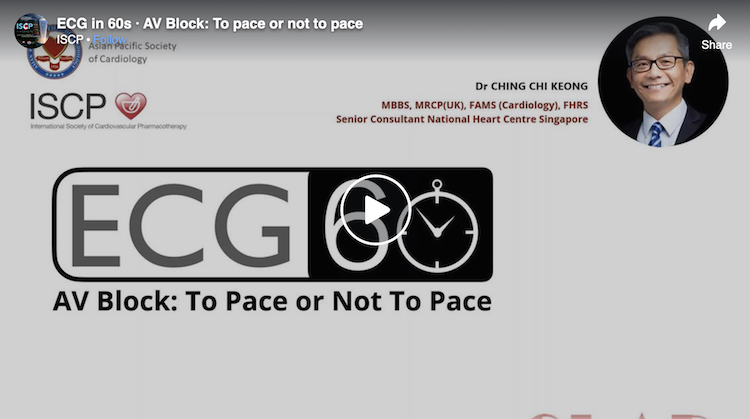 AV Block: To Pace or Not To Pace
